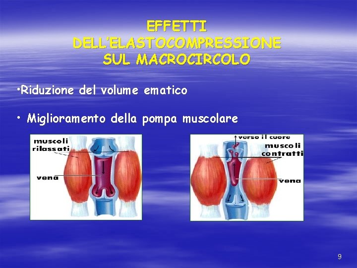 EFFETTI DELL’ELASTOCOMPRESSIONE SUL MACROCIRCOLO • Riduzione del volume ematico • Miglioramento della pompa muscolare EFFETTI DELL’ELASTOCOMPRESSIONE SUL MACROCIRCOLO • Riduzione del volume ematico • Miglioramento della pompa muscolare