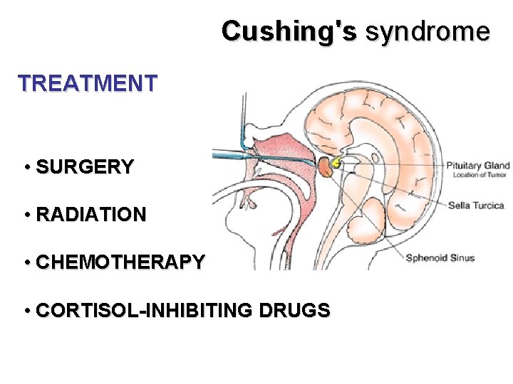 Cushing's syndrome TREATMENT • SURGERY • RADIATION • CHEMOTHERAPY • CORTISOL-INHIBITING DRUGS 