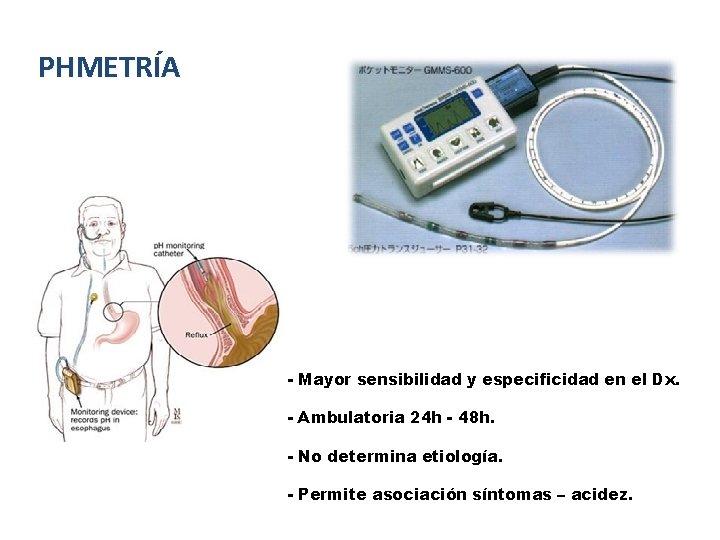 PHMETRÍA - Mayor sensibilidad y especificidad en el Dx. - Ambulatoria 24 h - PHMETRÍA - Mayor sensibilidad y especificidad en el Dx. - Ambulatoria 24 h -
