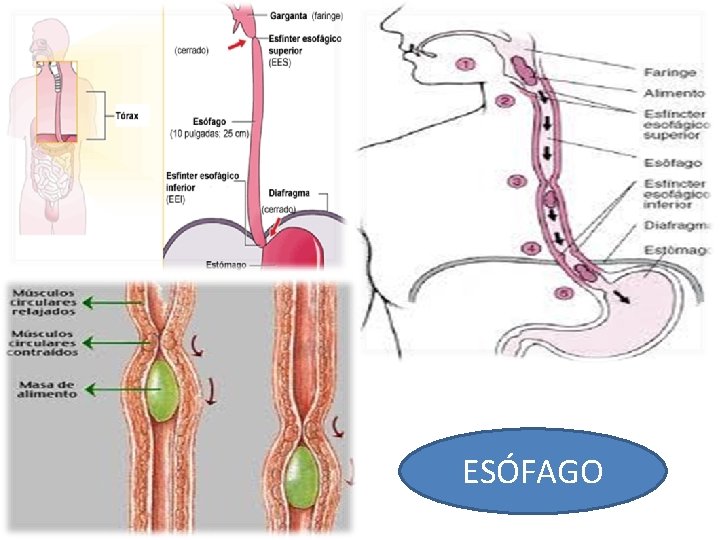 ESÓFAGO ESÓFAGO