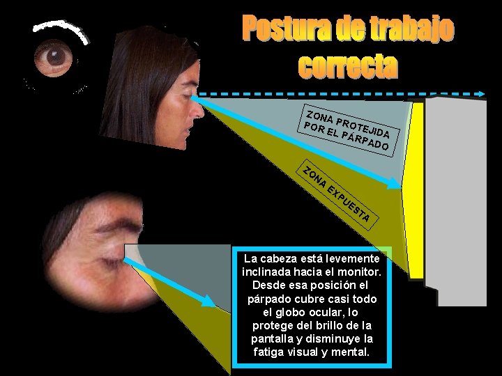 ZON A POR PROTE JI EL P ÁRP DA ADO ZO NA EX PU