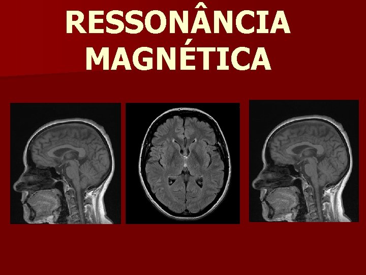 RESSON NCIA MAGNÉTICA 