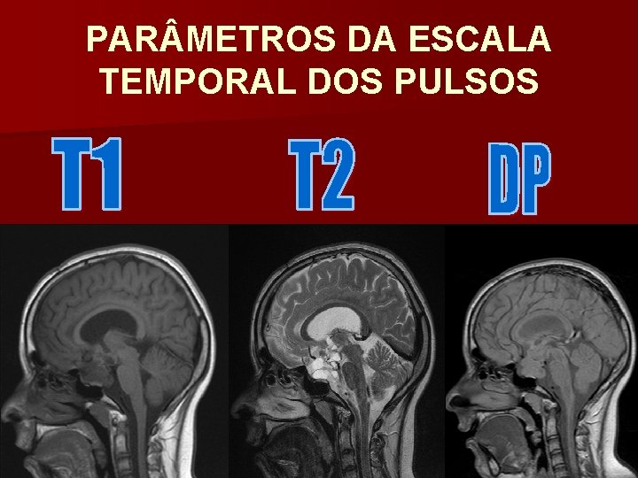 PAR METROS DA ESCALA TEMPORAL DOS PULSOS 