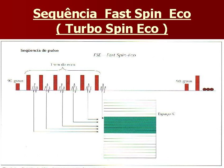 Sequência Fast Spin Eco ( Turbo Spin Eco ) 
