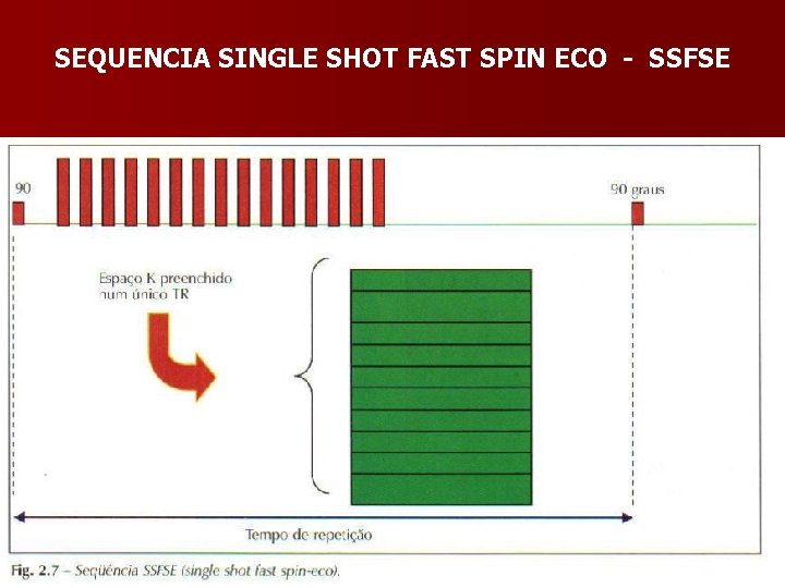 SEQUENCIA SINGLE SHOT FAST SPIN ECO - SSFSE 