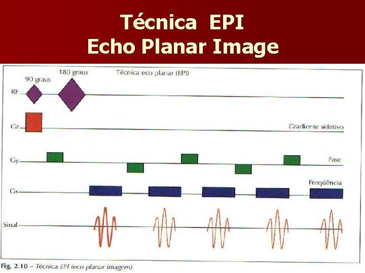 Técnica EPI Echo Planar Image 