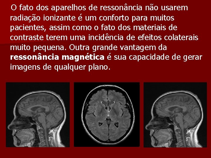  O fato dos aparelhos de ressonância não usarem radiação ionizante é um conforto