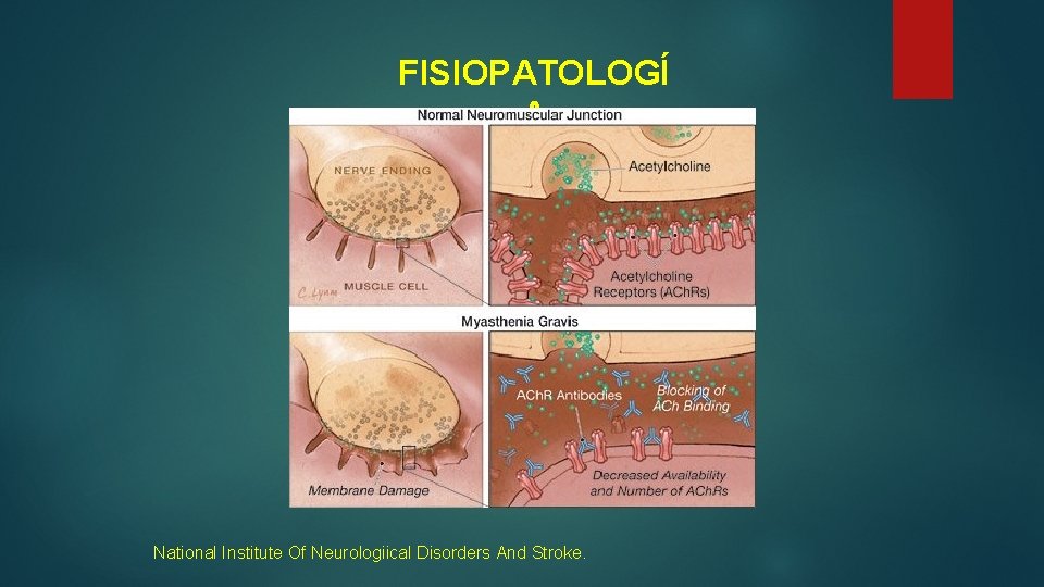 FISIOPATOLOGÍ A National Institute Of Neurologiical Disorders And Stroke. 