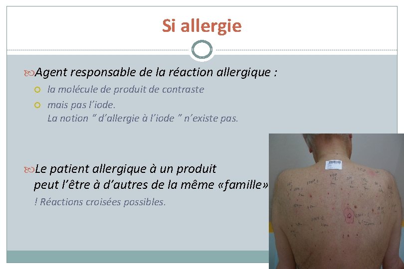 Si allergie Agent responsable de la réaction allergique : la molécule de produit de