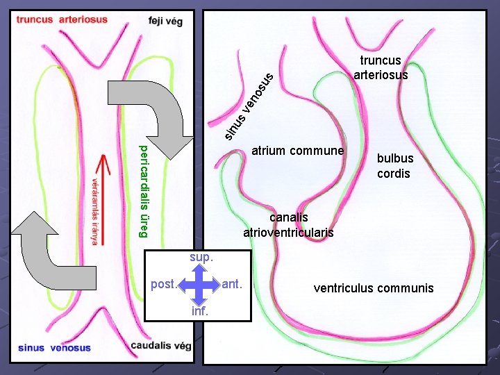 su s us ve no truncus arteriosus sin Kissé mechanikus megközelítéssel commune élve aatrium