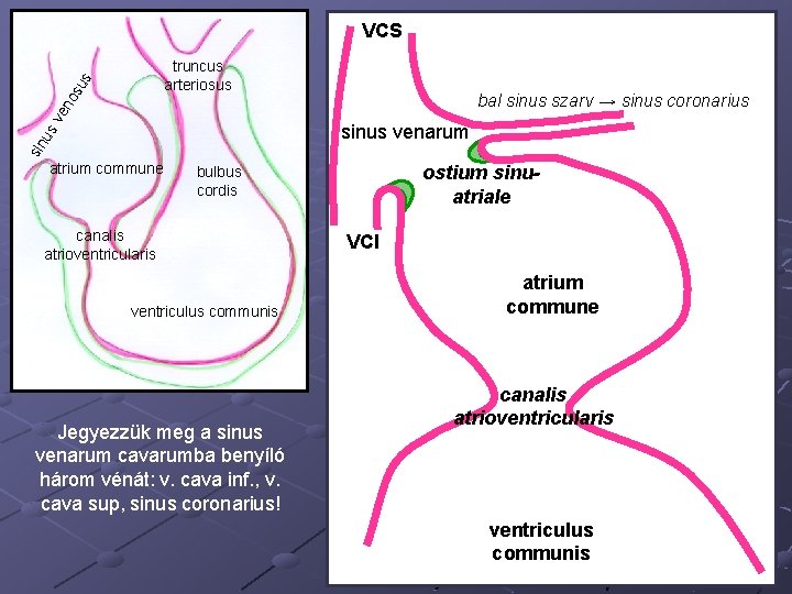 VCS bal sinus szarv → sinus coronarius sv en os us truncus arteriosus sin
