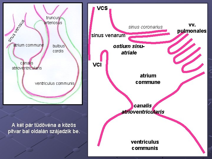 VCS sinus coronarius sv en os us truncus arteriosus sin u sinus venarum atrium