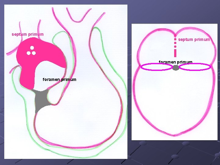 septum primum foramen primum 