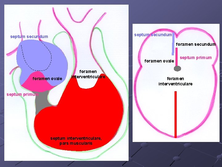 septum secundum foramen ovale foramen interventriculare septum primum septum interventriculare, pars muscularis septum primum