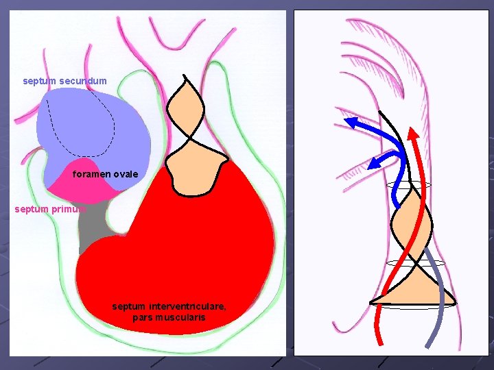 septum secundum foramen ovale septum primum septum interventriculare, pars muscularis 