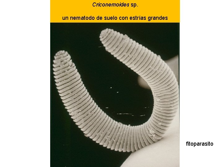 Criconemoides sp. un nematodo de suelo con estrías grandes fitoparasito Criconemoides sp. un nematodo de suelo con estrías grandes fitoparasito
