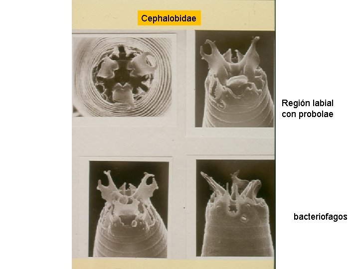 Cephalobidae Región labial con probolae bacteriofagos Cephalobidae Región labial con probolae bacteriofagos