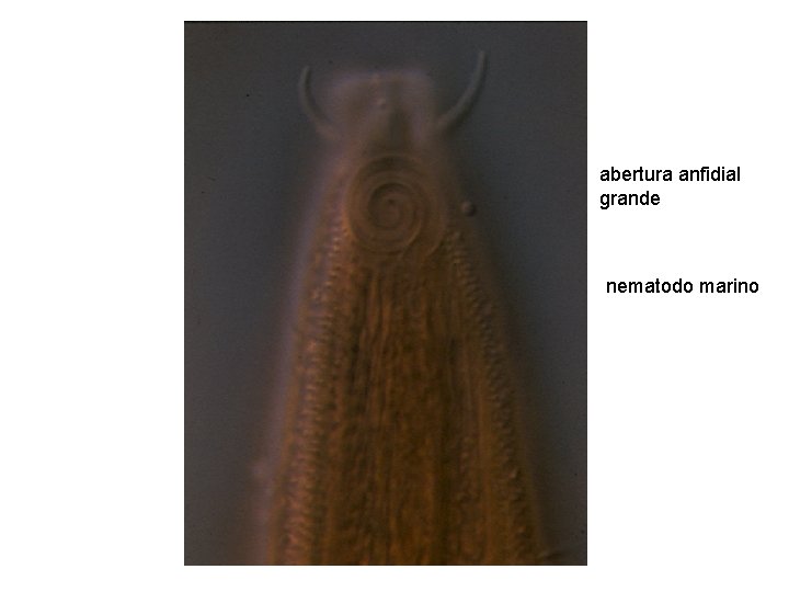 abertura anfidial grande nematodo marino abertura anfidial grande nematodo marino