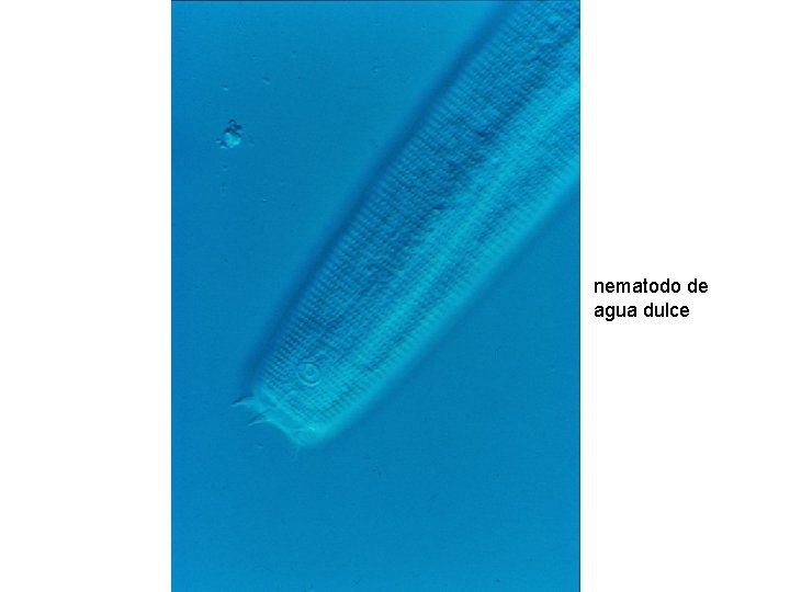 nematodo de agua dulce nematodo de agua dulce