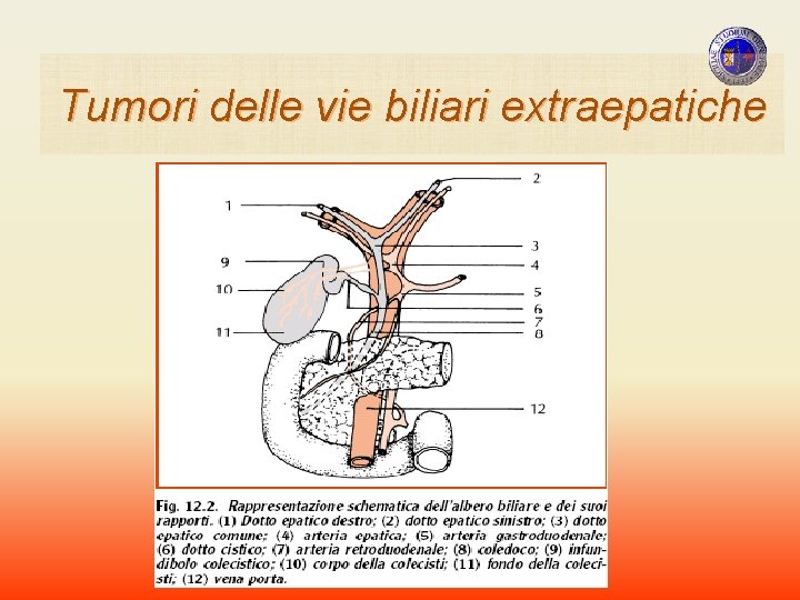 Tumori delle vie biliari extraepatiche Tumori delle vie biliari extraepatiche
