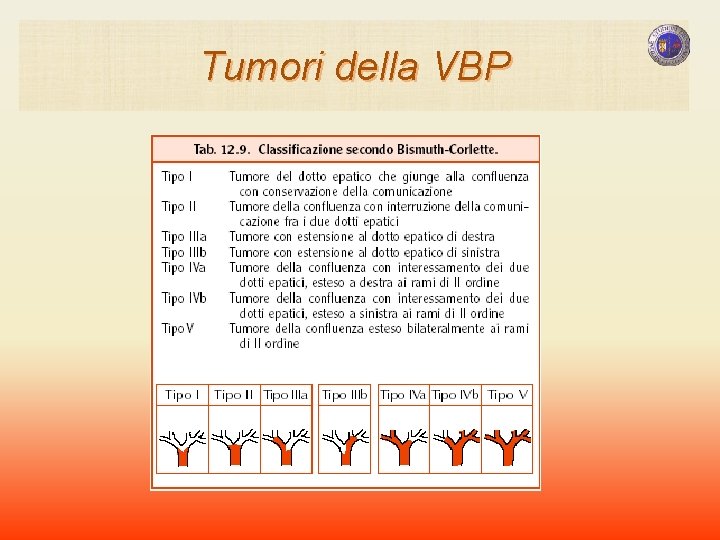 Tumori della VBP Tumori della VBP