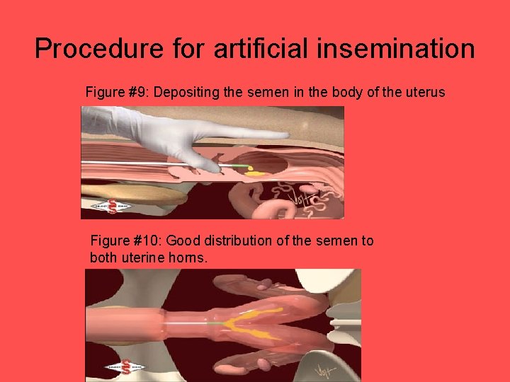 Procedure for artificial insemination Figure #9: Depositing the semen in the body of the