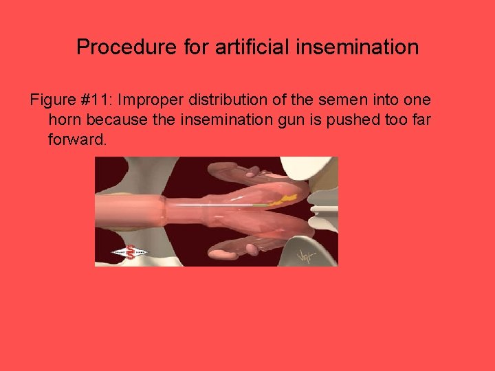 Procedure for artificial insemination Figure #11: Improper distribution of the semen into one horn