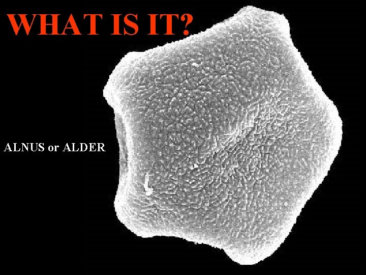 WHAT IS IT? ALNUS or ALDER 