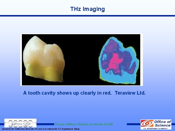 THz Imaging A tooth cavity shows up clearly in red. Teraview Ltd. Thomas Jefferson THz Imaging A tooth cavity shows up clearly in red. Teraview Ltd. Thomas Jefferson