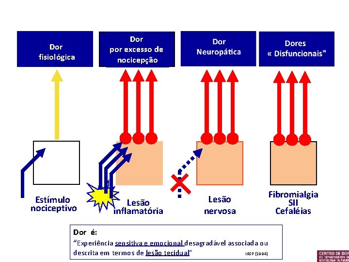 Dor fisiológica Estímulo nociceptivo Dor por excesso de nocicepção Lesão inflamatória Fibromialgia SII Cefaléias