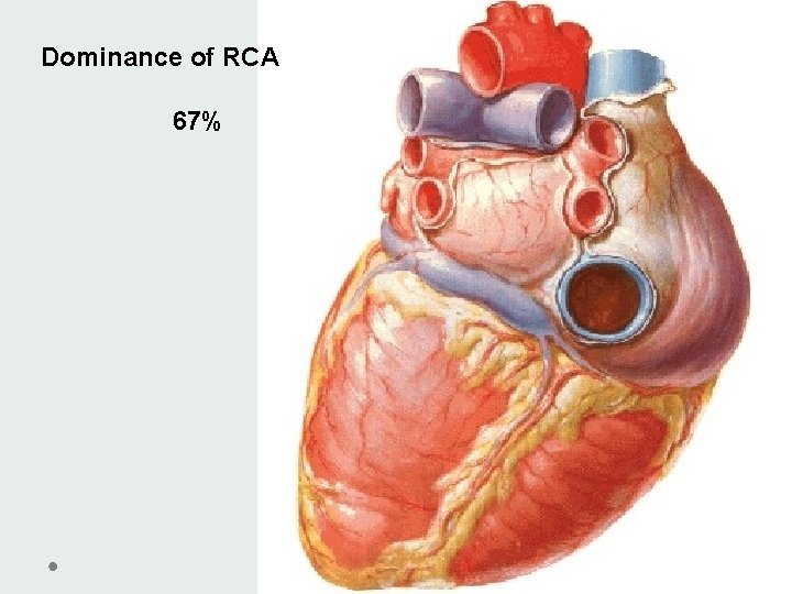 Dominance of RCA 67% Dominance of RCA 67%