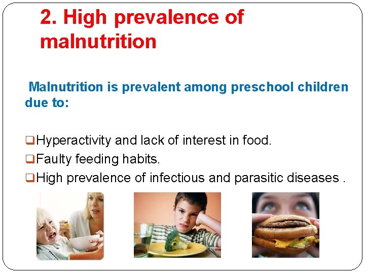2. High prevalence of malnutrition Malnutrition is prevalent among preschool children due to: q 2. High prevalence of malnutrition Malnutrition is prevalent among preschool children due to: q