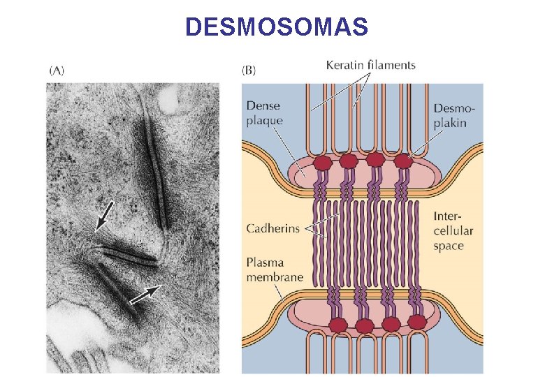 DESMOSOMAS DESMOSOMAS