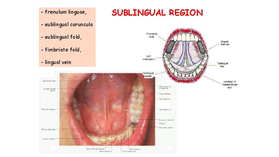 - frenulum linguae, - sublingual caruncula - sublingual fold, - fimbriate fold, - lingual - frenulum linguae, - sublingual caruncula - sublingual fold, - fimbriate fold, - lingual