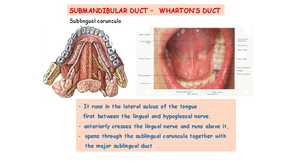 SUBMANDIBULAR DUCT – WHARTON’S DUCT Sublingual caruncula - It runs in the lateral sulcus SUBMANDIBULAR DUCT – WHARTON’S DUCT Sublingual caruncula - It runs in the lateral sulcus