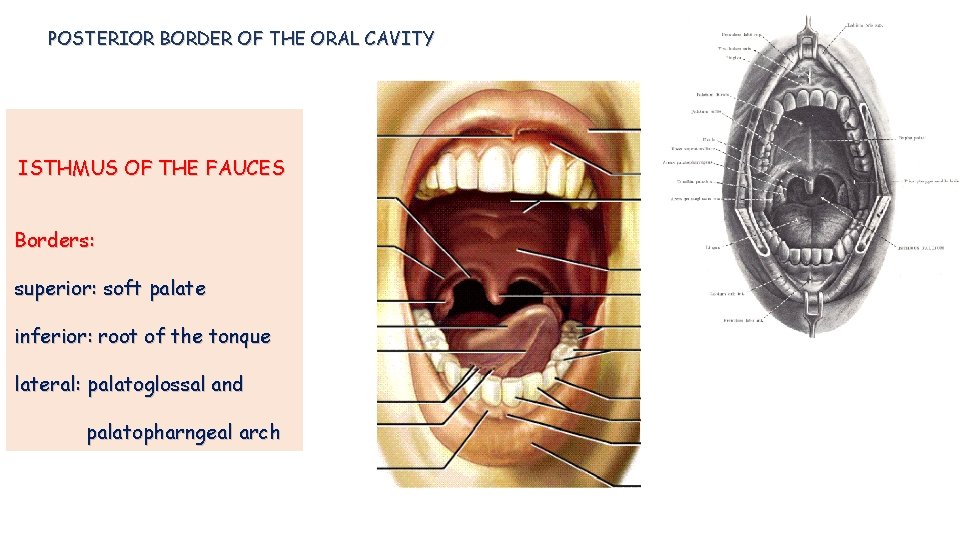 POSTERIOR BORDER OF THE ORAL CAVITY ISTHMUS OF THE FAUCES Borders: superior: soft palate POSTERIOR BORDER OF THE ORAL CAVITY ISTHMUS OF THE FAUCES Borders: superior: soft palate