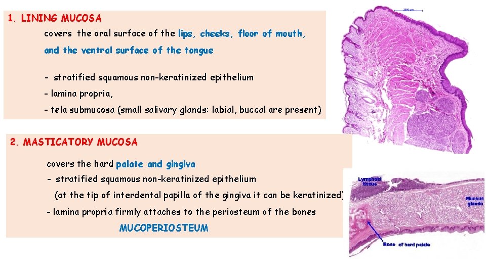 1. LINING MUCOSA covers the oral surface of the lips, cheeks, floor of mouth, 1. LINING MUCOSA covers the oral surface of the lips, cheeks, floor of mouth,