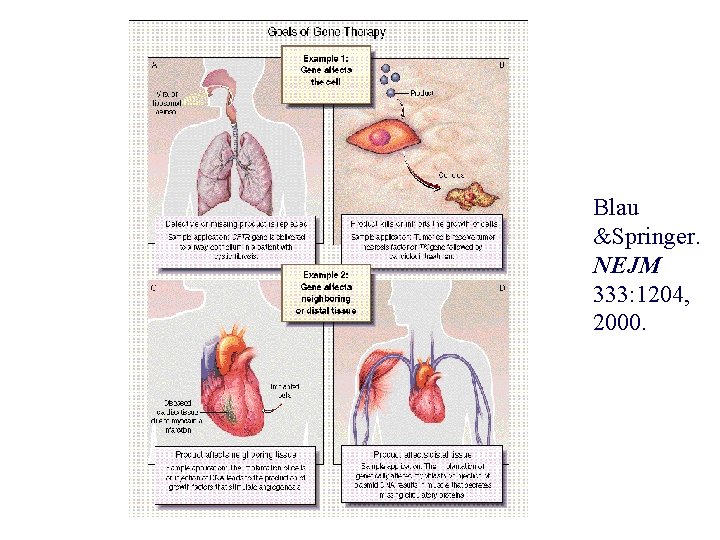 Blau &Springer. NEJM 333: 1204, 2000. Blau &Springer. NEJM 333: 1204, 2000.