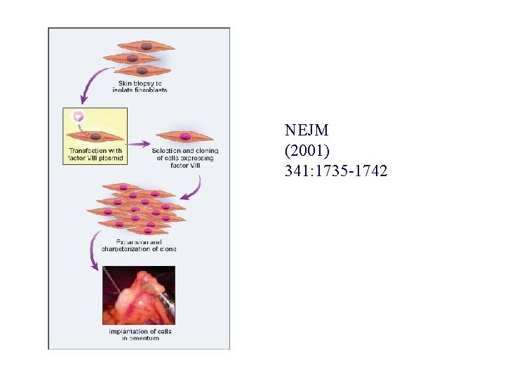 NEJM (2001) 341: 1735 -1742 NEJM (2001) 341: 1735 -1742
