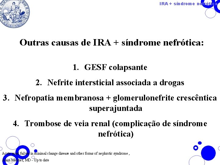 IRA + síndrome nefrótica Outras causas de IRA + síndrome nefrótica: 1. GESF colapsante