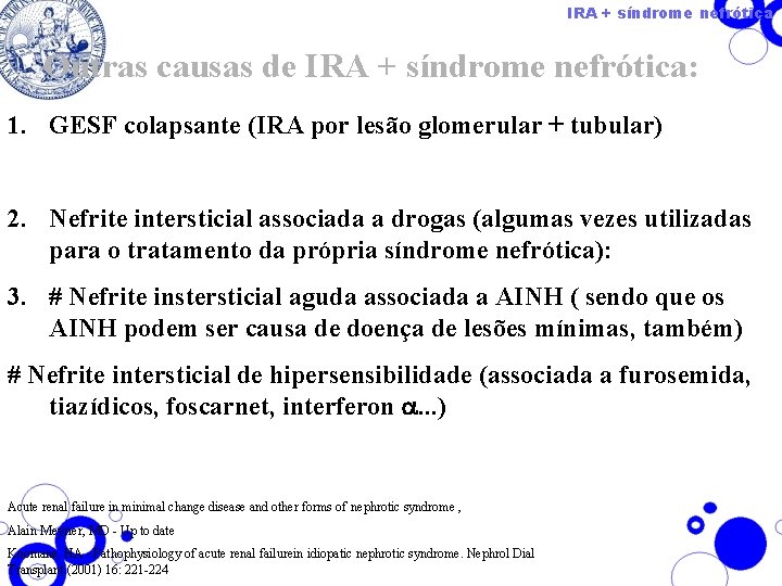 IRA + síndrome nefrótica Outras causas de IRA + síndrome nefrótica: 1. GESF colapsante