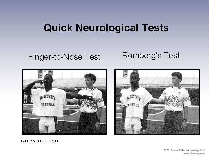 Quick Neurological Tests Finger-to-Nose Test Courtesy of Ron Pfeiffer Romberg’s Test 