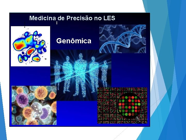 Medicina de Precisão no LES I 8 5 6 2 7 9 4 11