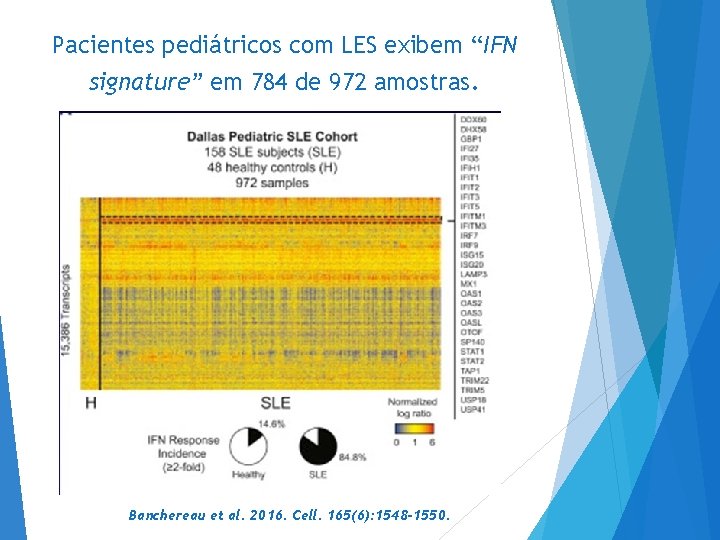 Pacientes pediátricos com LES exibem “IFN signature” em 784 de 972 amostras. Banchereau et