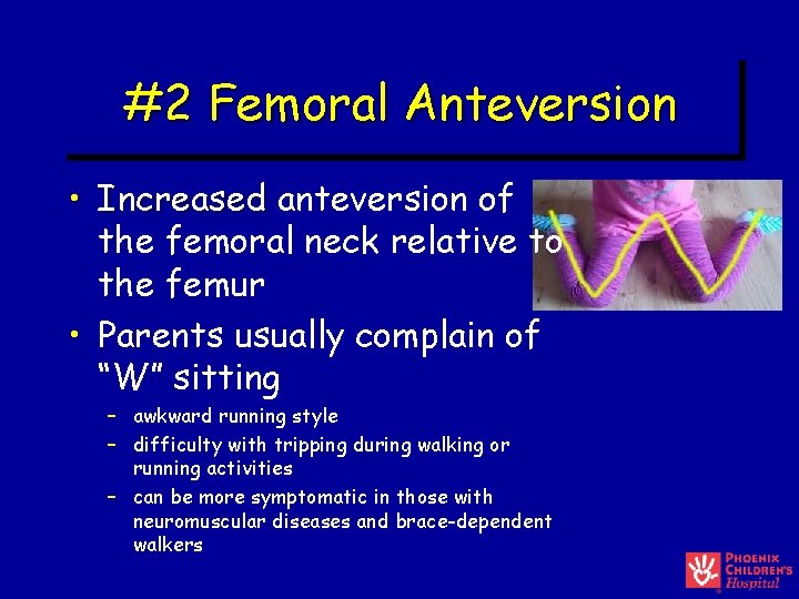 #2 Femoral Anteversion • Increased anteversion of the femoral neck relative to the femur #2 Femoral Anteversion • Increased anteversion of the femoral neck relative to the femur
