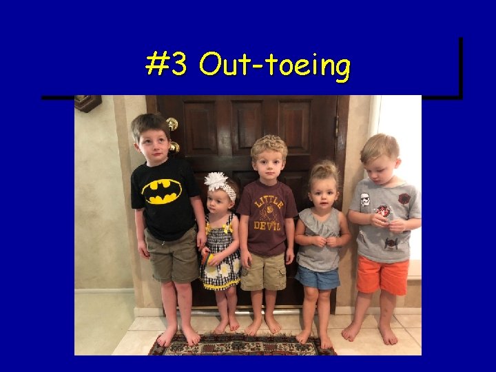 #3 Out-toeing #3 Out-toeing