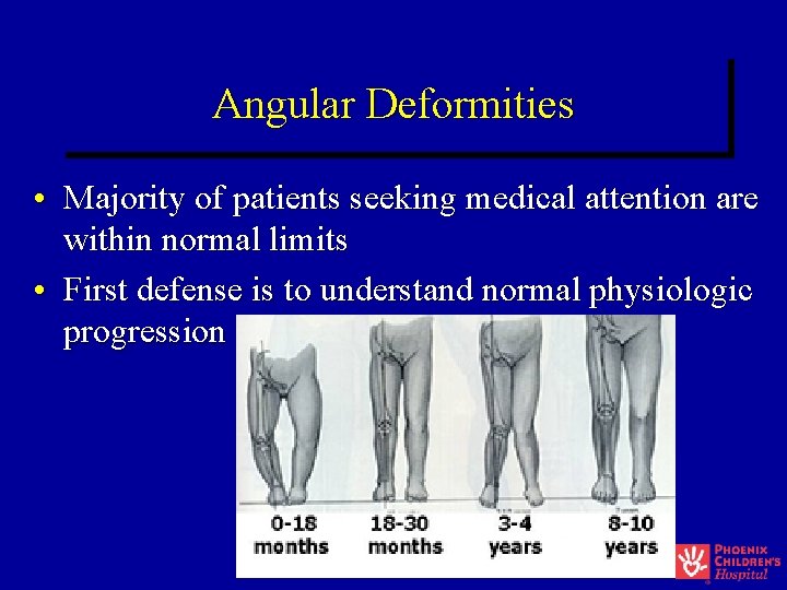 Angular Deformities • Majority of patients seeking medical attention are within normal limits • Angular Deformities • Majority of patients seeking medical attention are within normal limits •