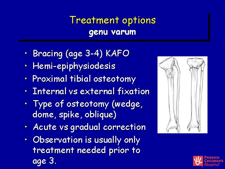 Treatment options genu varum • • Bracing (age 3 -4) KAFO Hemi-epiphysiodesis Proximal tibial Treatment options genu varum • • Bracing (age 3 -4) KAFO Hemi-epiphysiodesis Proximal tibial
