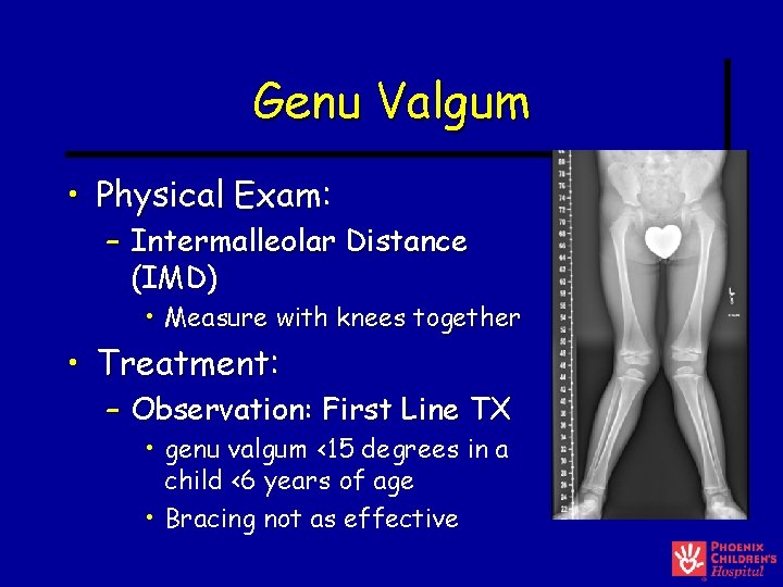 Genu Valgum • Physical Exam: – Intermalleolar Distance (IMD) • Measure with knees together Genu Valgum • Physical Exam: – Intermalleolar Distance (IMD) • Measure with knees together
