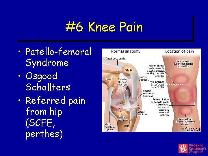 #6 Knee Pain • Patello-femoral Syndrome • Osgood Schallters • Referred pain from hip #6 Knee Pain • Patello-femoral Syndrome • Osgood Schallters • Referred pain from hip